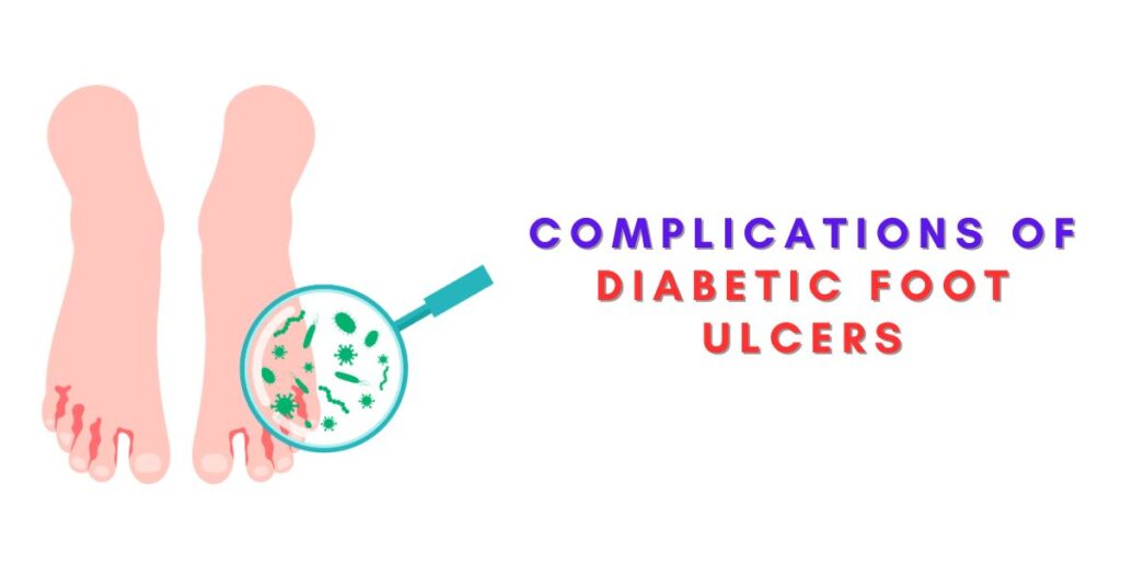 complications of Diabetic Foot Ulcers